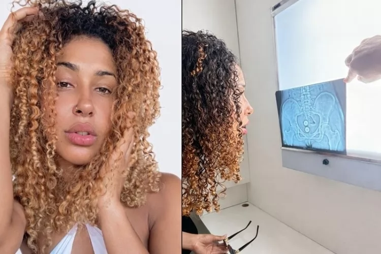 Influenciadora relata uso indevido de fotos após acidente com bolas de pompoarismo